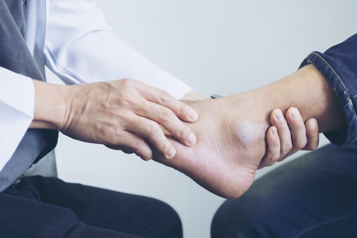 Treating-Ankle-Sprain