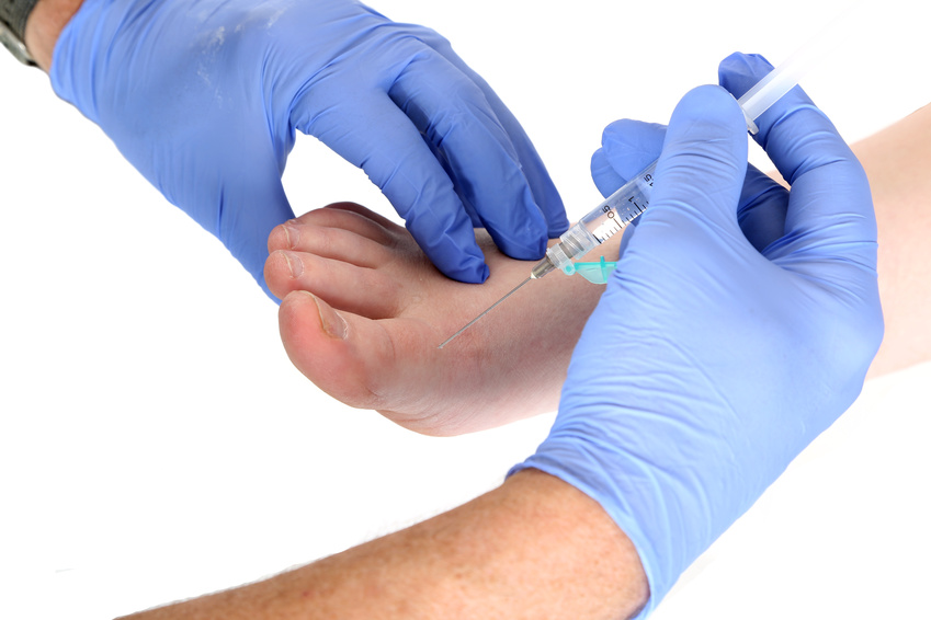 cortisone-injection-therapy