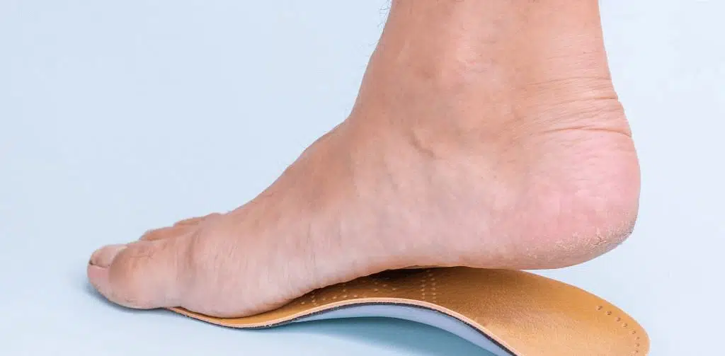 man-tries-on-orthotic-with-flat-foot-problem