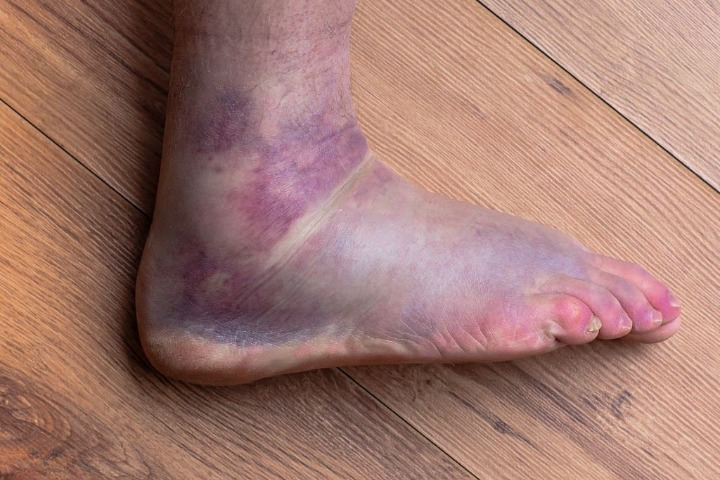 Purple Feet