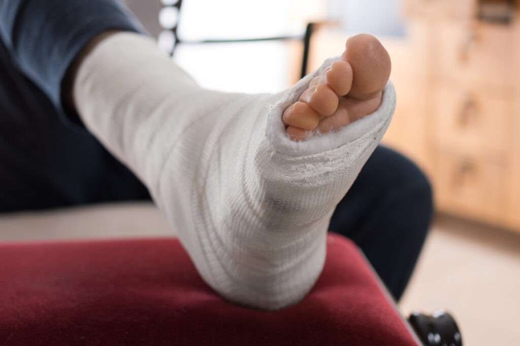 feet with bandage recovering from tendon surgery