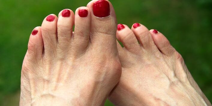 Can Hammertoes Be Dangerous?: Premier Foot and Ankle Center